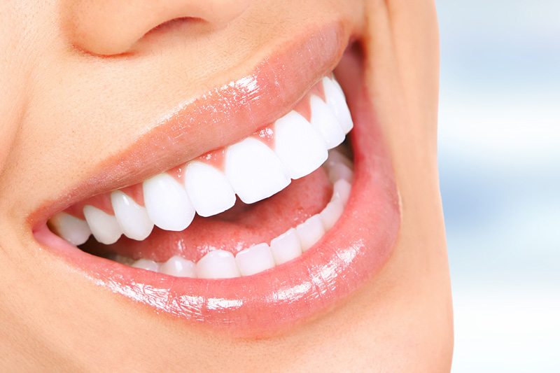 Cosmetic Dentistry in Chicopee