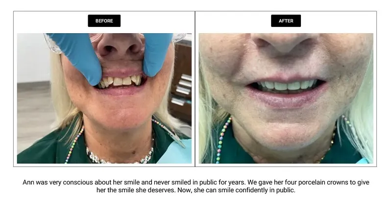 Before and After dental appointment
