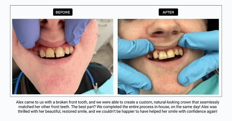 Before and After dental appointment